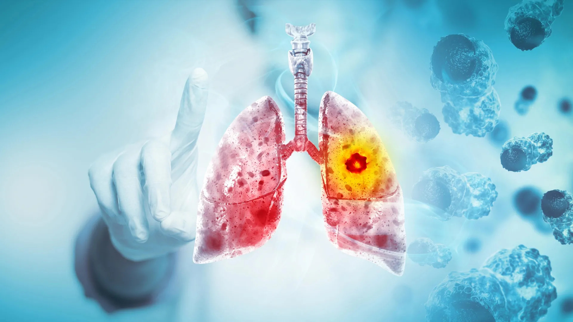 New study sheds light on why lung cancer returns