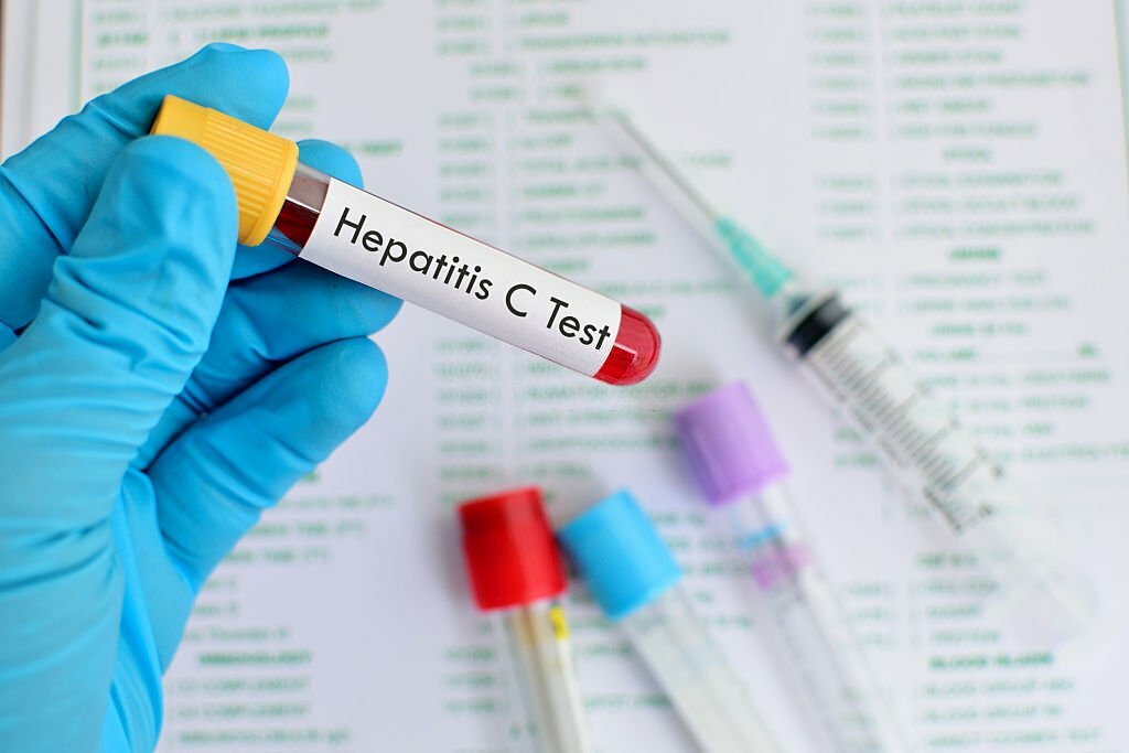 More action needed to meet 2030 hepatitis elimination targets: WHO report