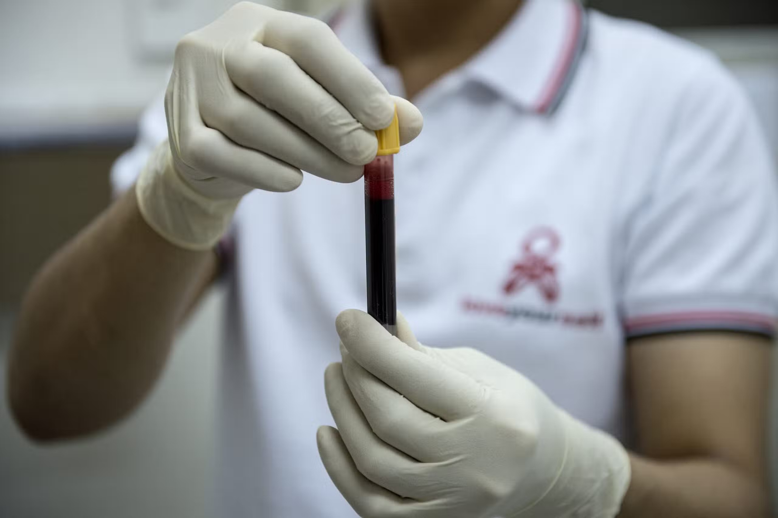 Norwegian man effectively cured of HIV after rare stem cell transplant, medics say