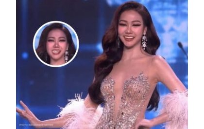 Veneers fall out of Miss Grand Thailand contestant’s mouth on stage